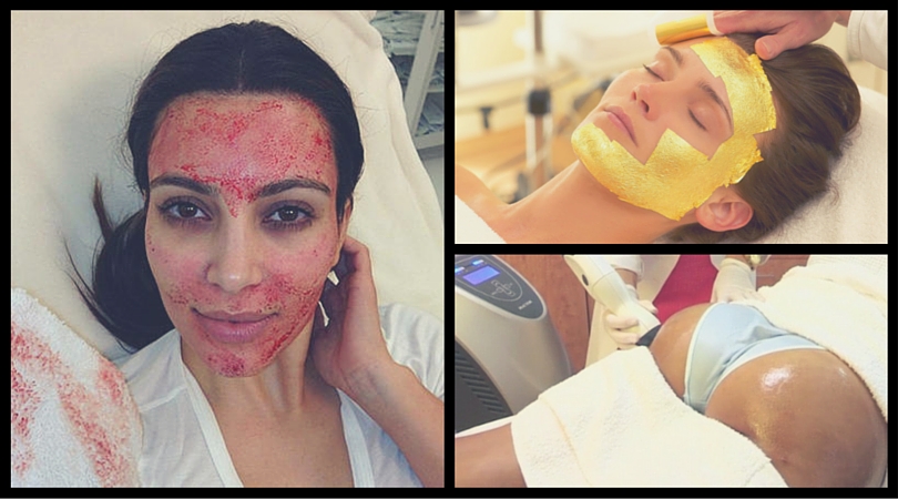 Bizzare Beauty Treatments vampire facial